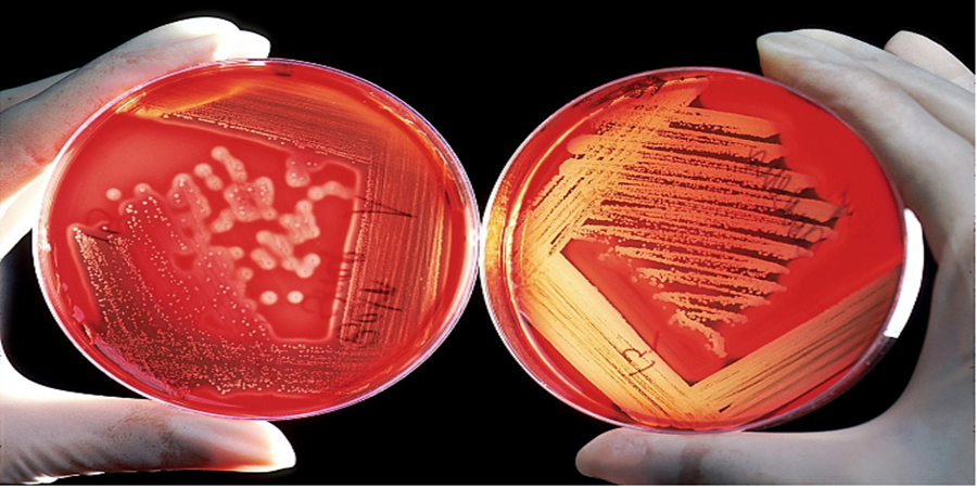 As infecções por Vibrio vulnificus estão se espalhando pelos EUA devido às mudanças climáticas/Cortesia Editorial Pixabay